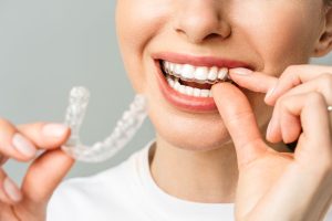ortodoncia-invisible-caceres-rc-clinica-dental